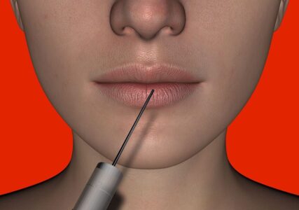 Lee más sobre el artículo El Botox para los labios ¿Realmente se recomienda?